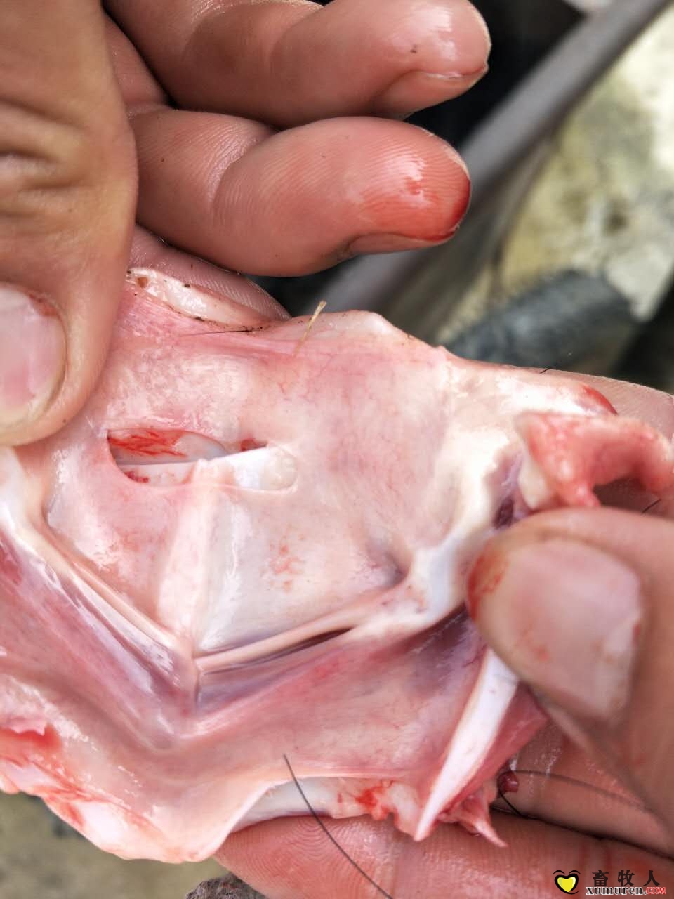 喉头有出血点